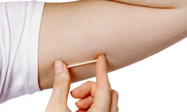 импланон контрацептив киев 1